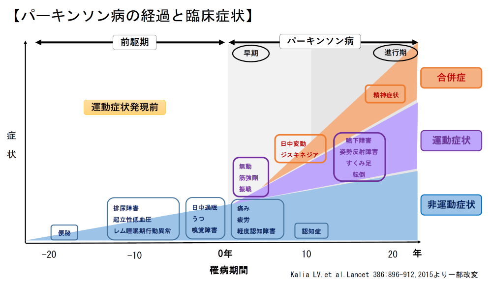 パーキンソン病の診断基準は何ですか?